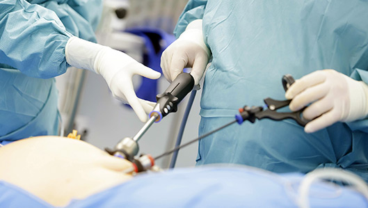 Minimal-invasive Chirurgie